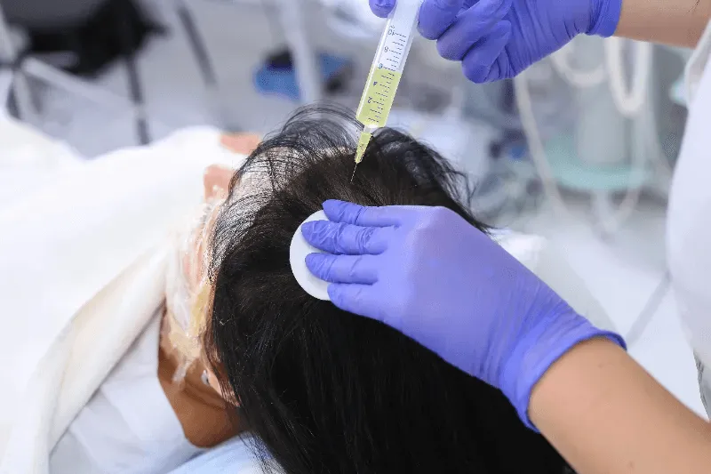 The image shows a hair growth treatment where a healthcare professional injects a solution into the patient's scalp