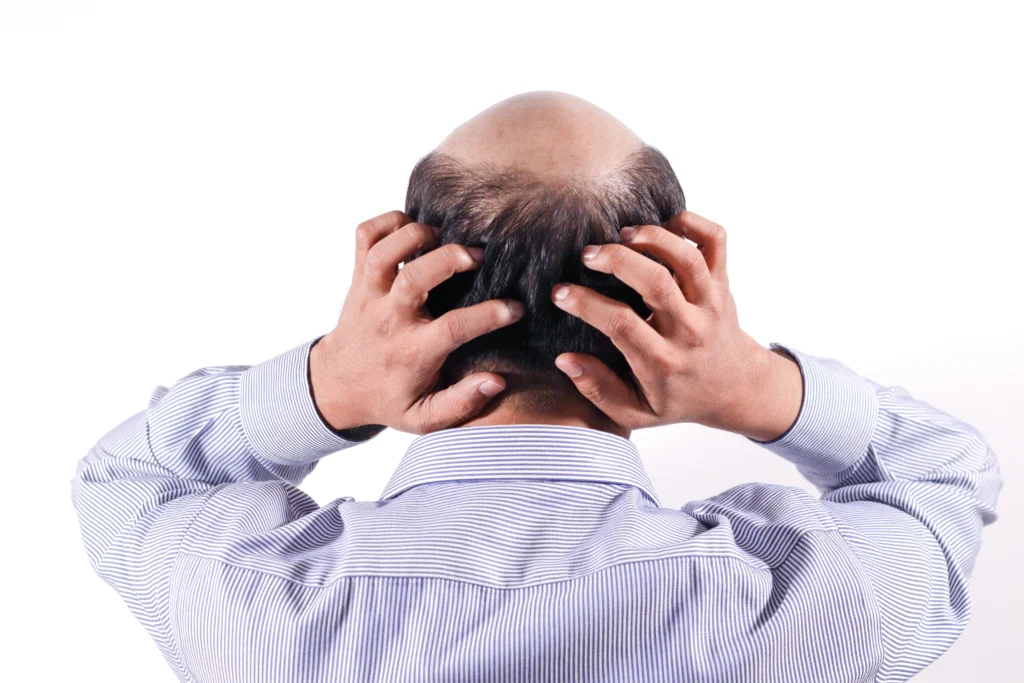 The Common Causes of Hair Thinning and Loss