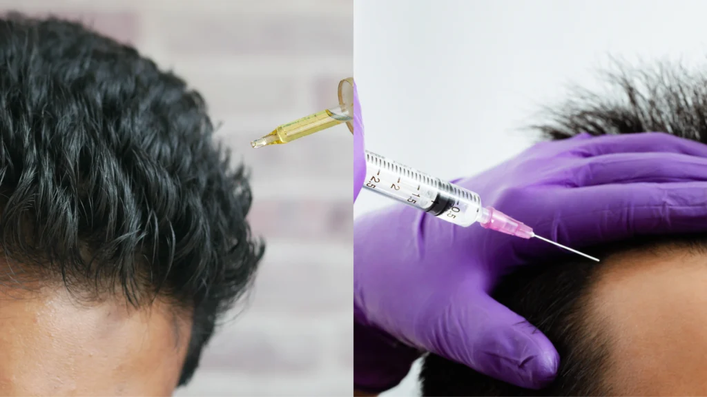 Comparison of QR 678 hair treatment with other modes of treatment